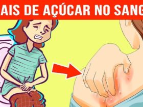 sinas de açucar no sangue