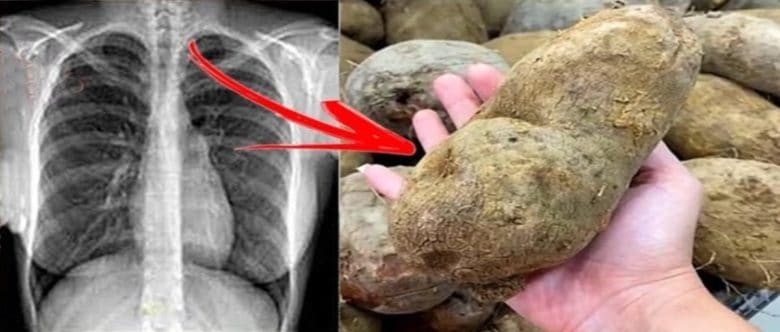 entenda por que voce deveria comecar a comer mais inhame