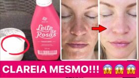 Pele Limpa e Sem Manchas: Leite de Rosas