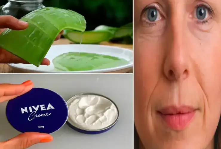 Babosa com creme Nivea no rosto para reduzir rugas naturalmente