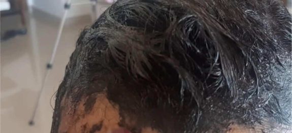 veja um jeito pratico e facil de como tirar tinta de cabelo da pele