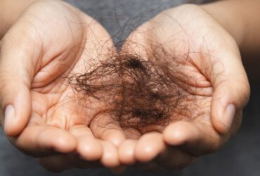 e vitamina d pode causar queda de cabelo