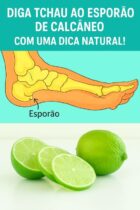Diga adeus ao Esporão de Calcâneo com Dica Natural!