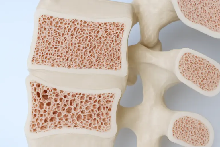 Cuidado: Bebida Prejudicial para os Ossos!