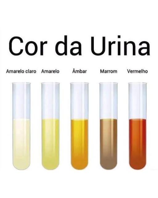 cor da urina indica sobre sua saúde