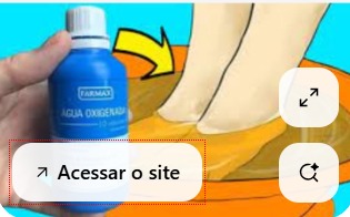 micose