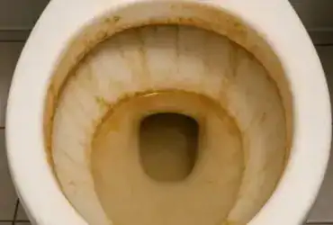 Vaso sanitário com acúmulo de calcário, ilustrando dicas de limpeza profissional para remover manchas no banheiro