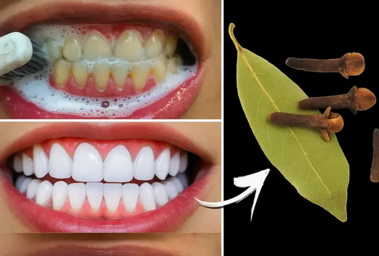 Clareie os Dentes Naturalmente em Poucos Minutos 88 Clareie os Dentes Naturalmente em Poucos Minutos