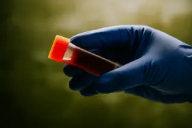 Pesquisadores revelam qual grupo sanguíneo tem o menor risco de câncer