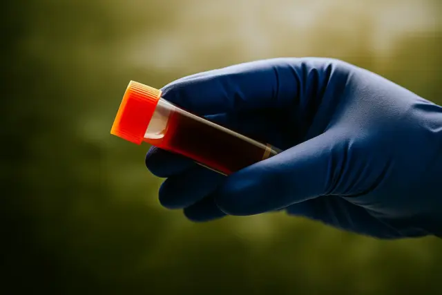 Limpeza do cólon: o suco natural que ajuda a eliminar toxinas 3 Pesquisadores revelam qual grupo sanguíneo tem o menor risco de câncer