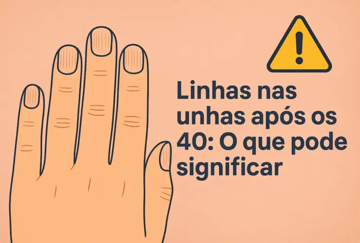 linhas nas suas unhas depois dos 40