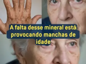 manchas de idade na sua pele