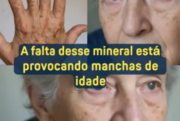 manchas de idade na sua pele