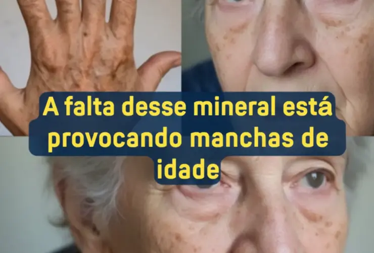 manchas de idade na sua pele
