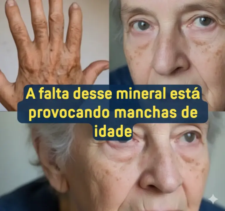 manchas de idade na sua pele
