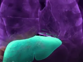 Infográfico médico mostrando o fígado humano saudável