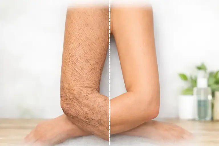 Como Cuidar da Pele Envelhecida: